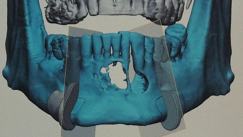 Ставропольцам напомнили в предновогодье, как действовать в случае получения травм