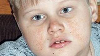 Ростислав Кубарев с туберозным склерозом и эпилепсией нуждается в тренажере