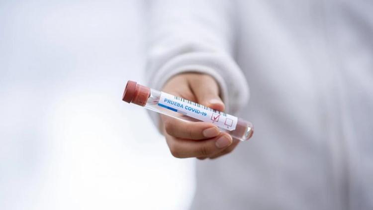 Лаборатории Ставрополья провели свыше 1 миллиона 283 тысяч COVID-тестов