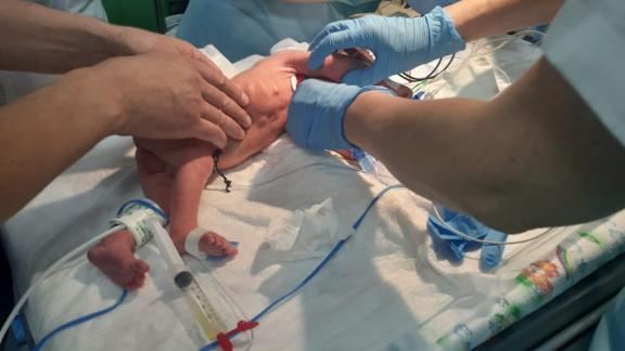 Ставропольские медики выполнили уникальную операцию новорожденному