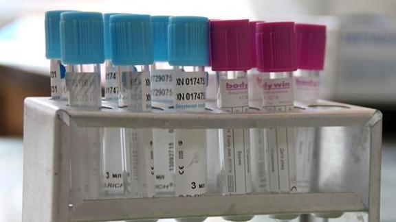 Лаборатории Ставрополья провели почти 713 тысяч тестов на коронавирус