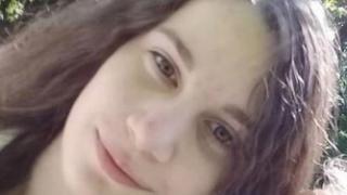 17-летнюю кисловодчанку со шрамом на щеке ищут родственники