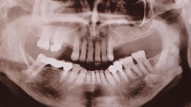 В невинномысской городской стоматологической поликлинике появился новый 3D томограф
